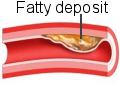 fatty deposits in blood vessels