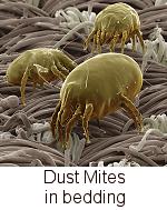 dust mites