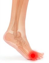 What are some of the problems associated with poor circulation in the foot?