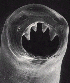 hookworm