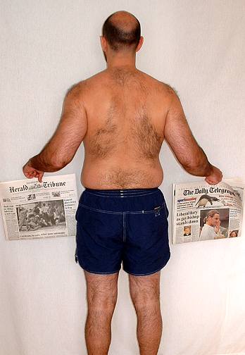 picture of back
