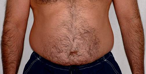 stomach photo
